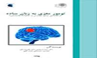 تالیف کتاب تومور مغزی به زبان ساده 